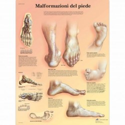 KunLS Poster Anatomia Umana Poster Medicina per Aule, Cliniche, Ospedali,  Studi Medici Poster di Anatomia Senza Cornice C,60X80CM No Frame