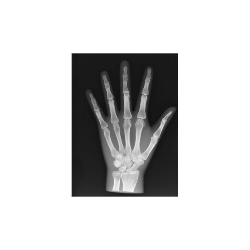 Simulatore per radiologia - Mano - Opaco - Erler Zimmer 7215