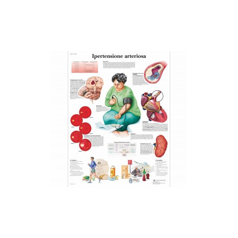 3B Scientific, tavola anatomica, Ipertensione Arteriosa (cod, VR4361L)