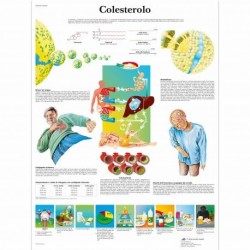 3B Scientific tavola anatomica Poster Osteoporosi cod VR4121L