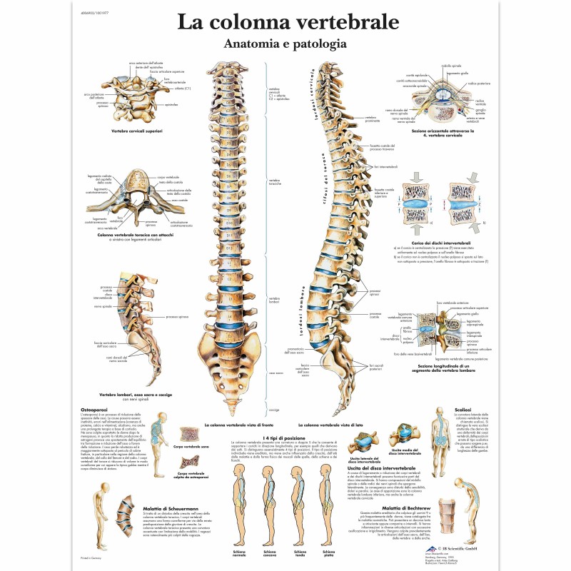 3B Scientific, tavola anatomica, La colonna vertebrale, anatomia e patologia (cod, VR4152UU)