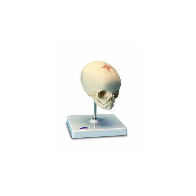 Cranio di feto, su cavalletto (cod, A26)